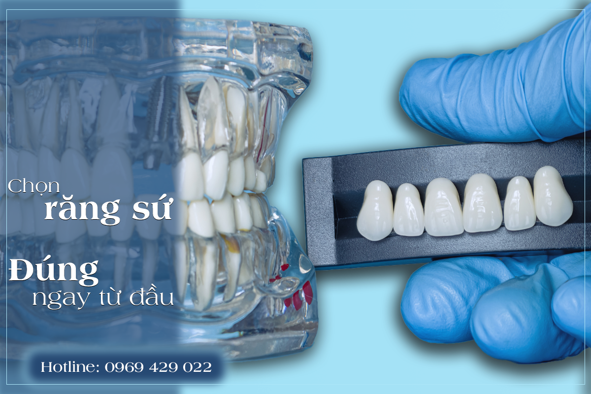 Trước khi làm răng sứ, nhiều người bối rối vì có quá nhiều lựa chọn: Zirconia, Cercon, Lava, Veneer… dòng nào cũng được giới thiệu là “tốt”. Thực tế, vấn đề không nằm ở việc chọn dòng sứ đắt hay rẻ, mà là chọn có đúng với tình trạng răng và nhu cầu sử dụng hay không. Bài viết này giúp bạn hiểu rõ vai trò của từng dòng răng sứ phổ biến, để đưa ra quyết định phù hợp trước khi thay đổi nụ cười.