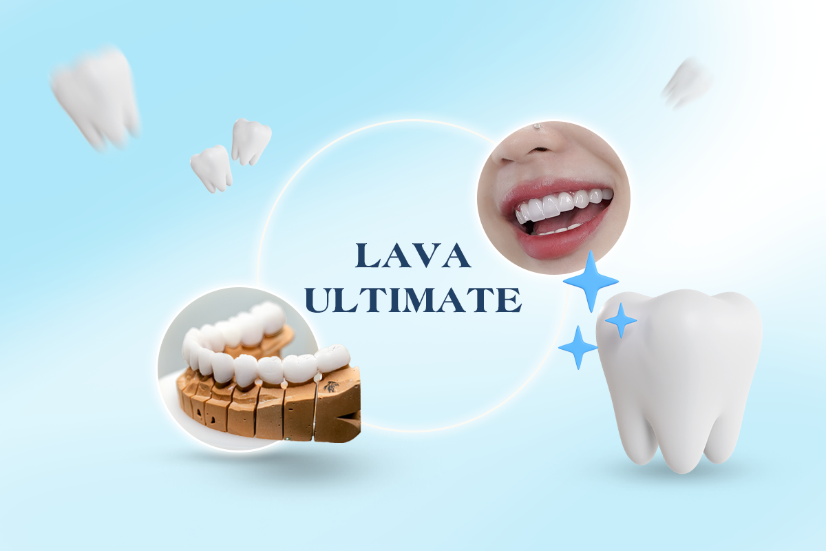 Răng sứ Lava Ultimate là dòng resin nano ceramic CAD/CAM thuộc hệ thống Lava của 3M (Hoa Kỳ) – thương hiệu vật liệu nha khoa hàng đầu thế giới. Khác với các dòng răng sứ Zirconia nguyên khối, Lava Ultimate được cấu tạo từ sự kết hợp giữa nhựa resin thế hệ mới và các hạt sứ nano siêu mịn.