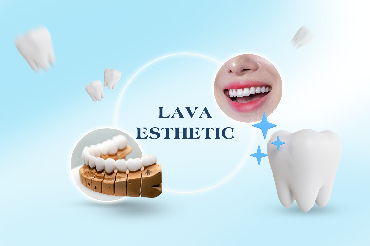 Răng sứ Lava Esthetic là dòng răng sứ toàn sứ cao cấp thuộc hệ thống Lava của 3M (Hoa Kỳ) – thương hiệu vật liệu nha khoa nổi tiếng toàn cầu với các dòng sứ thẩm mỹ chất lượng cao.