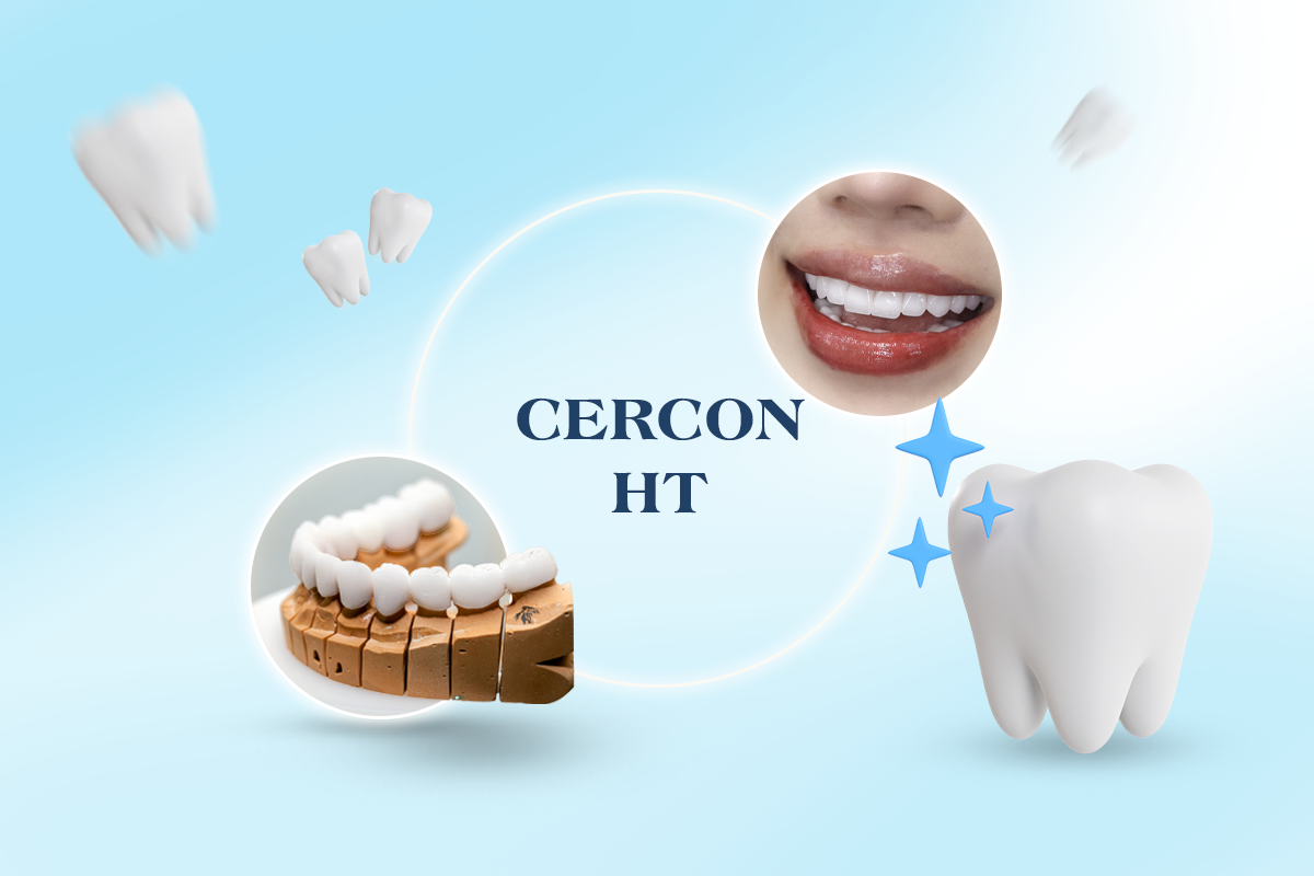 Răng sứ Cercon HT là dòng răng sứ toàn sứ được nhắc đến nhiều nhờ khả năng tái tạo màu sắc tự nhiên, hạn chế cảm giác “giả sứ” và vẫn đảm bảo độ ổn định trong quá trình sử dụng.