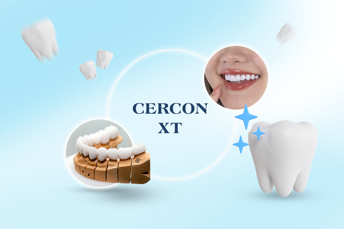 Răng sứ Cercon XT được xem là một trong những dòng răng sứ toàn sứ đáp ứng tốt nhất xu hướng thẩm mỹ mới – nơi vẻ đẹp không đến từ sự “nổi bật”, mà từ cảm giác tự nhiên khi nhìn và khi cười.