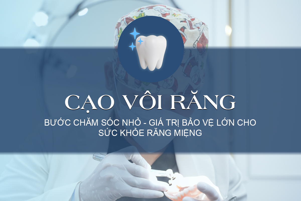 Cạo vôi răng (hay còn gọi là lấy cao răng) là phương pháp loại bỏ mảng bám đã bị vôi hóa trên bề mặt răng bằng các dụng cụ nha khoa chuyên dụng hoặc bằng máy cạo vôi răng bằng sóng siêu âm.
