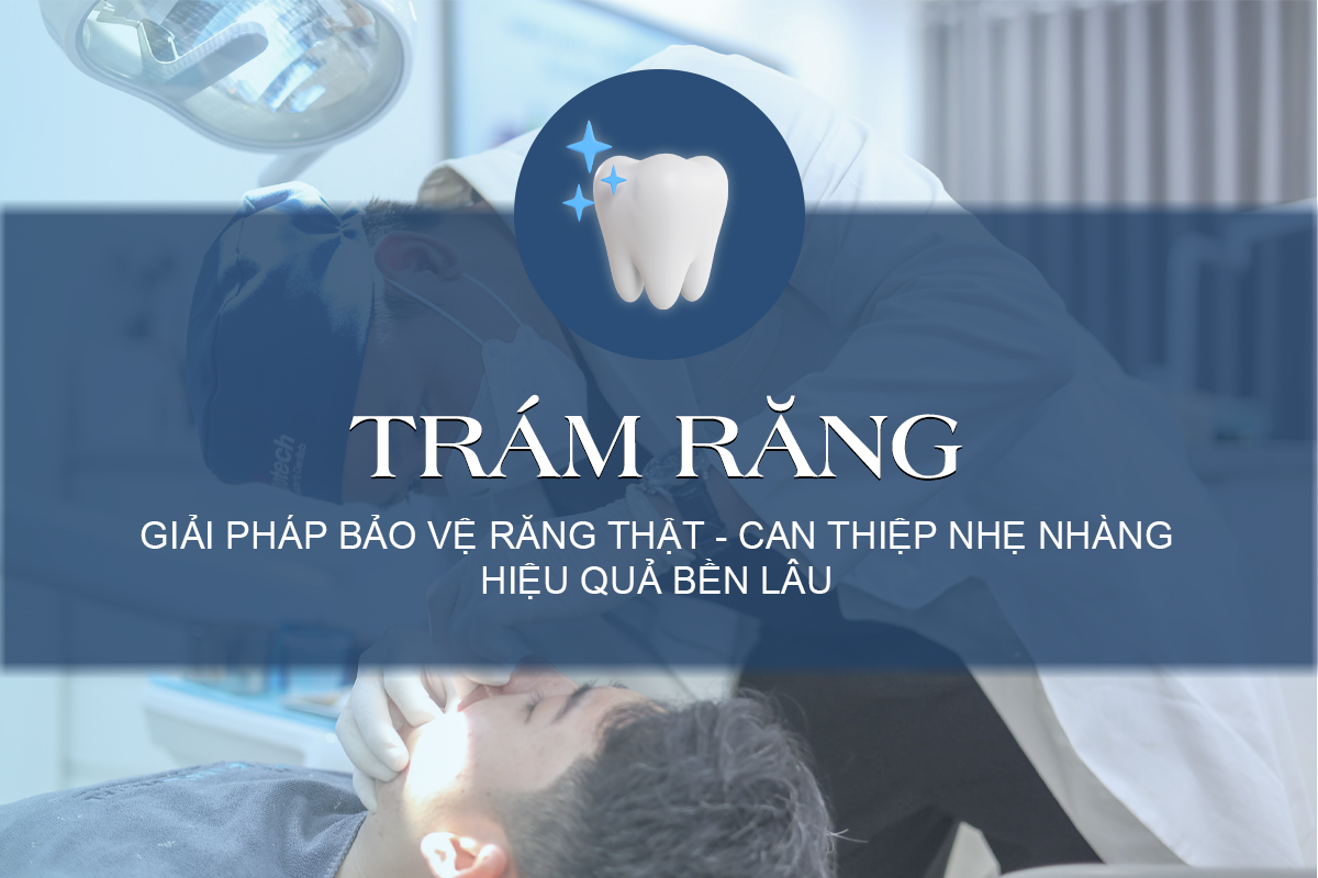 Trám răng là phương pháp sử dụng vật liệu nha khoa chuyên dụng để lấp đầy các vùng răng bị tổn thương như sâu răng, sứt mẻ, mòn cổ răng hoặc khe hở nhỏ giữa các răng. Sau khi trám, răng được phục hồi hình dáng ban đầu, hạn chế vi khuẩn xâm nhập và tiếp tục phá hủy cấu trúc răng.