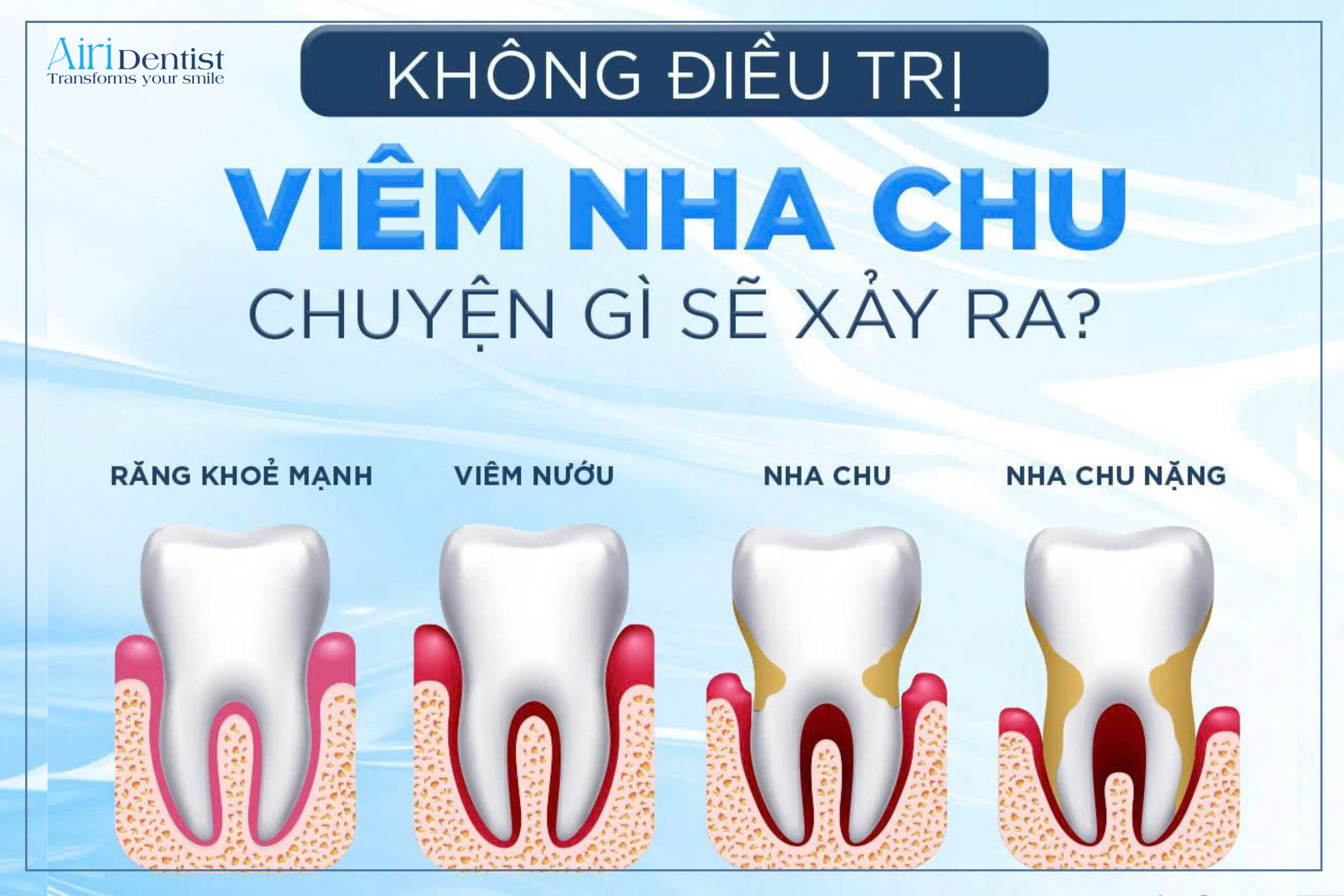 Đừng để sự chủ quan làm mất đi nụ cười! 5 hậu quả khôn lường và tầm quan trọng của việc điều trị viêm nha chu chuẩn y khoa ngay hôm nay.