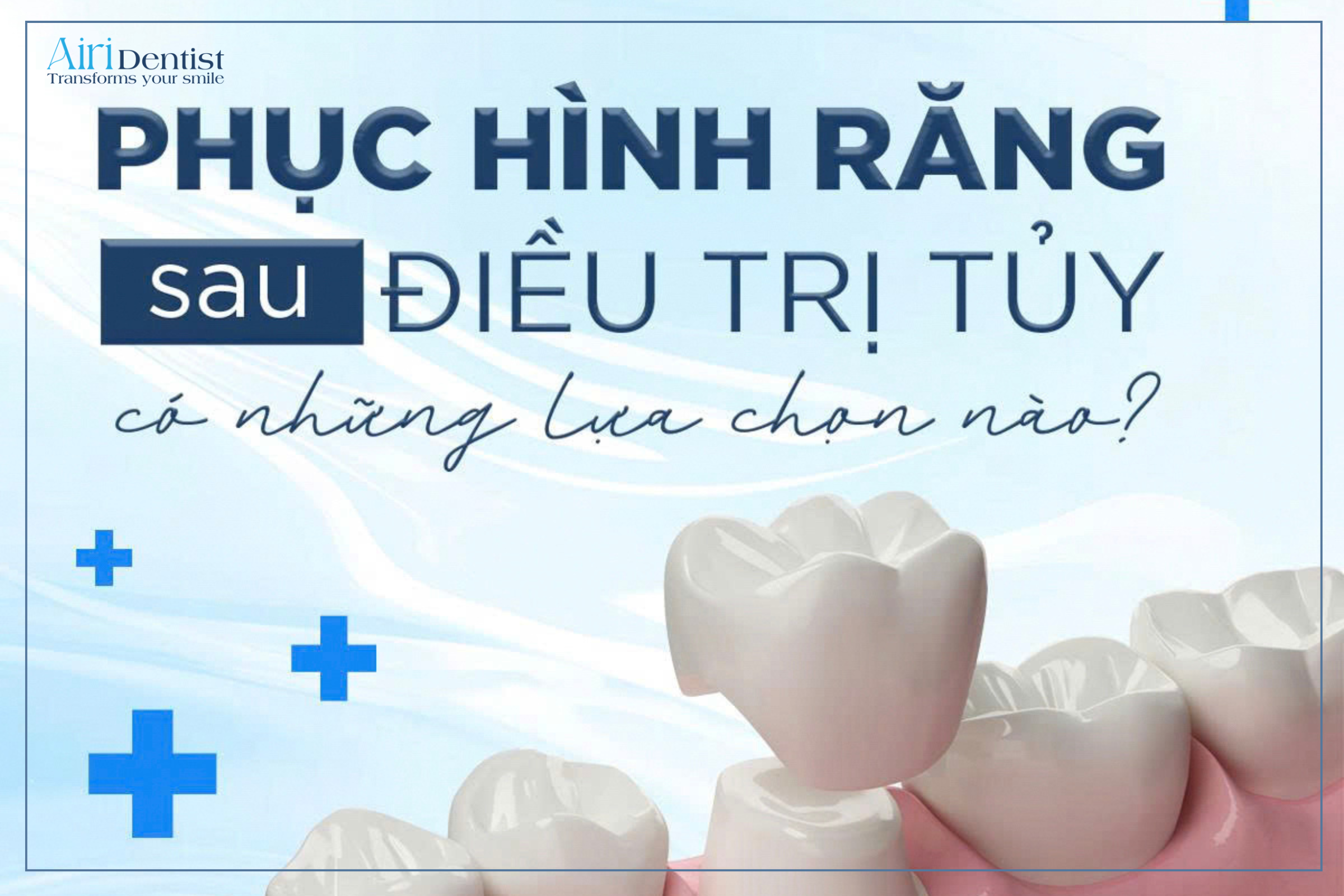 Phục hình răng sau điều trị tủy có những lựa chọn nào? Khám phá ngay ưu nhược điểm của phương pháp trám răng và bọc sứ để bảo vệ nụ cười của bạn.