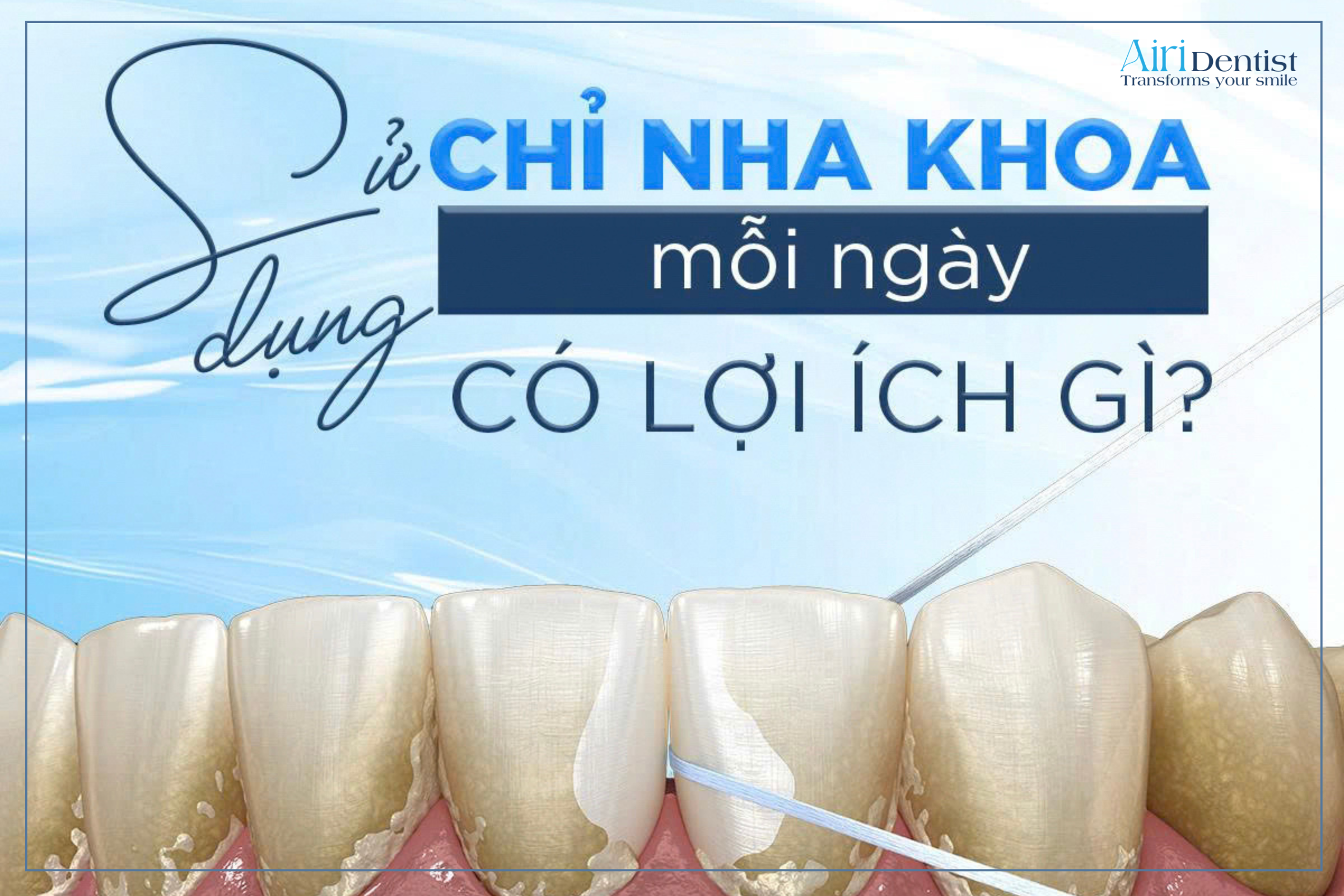 Bàn chải thông thường chỉ làm sạch 60% mảng bám. Xem ngay bài viết để hiểu rõ tầm quan trọng của việc sử dụng chỉ nha khoa đúng cách, an toàn.
