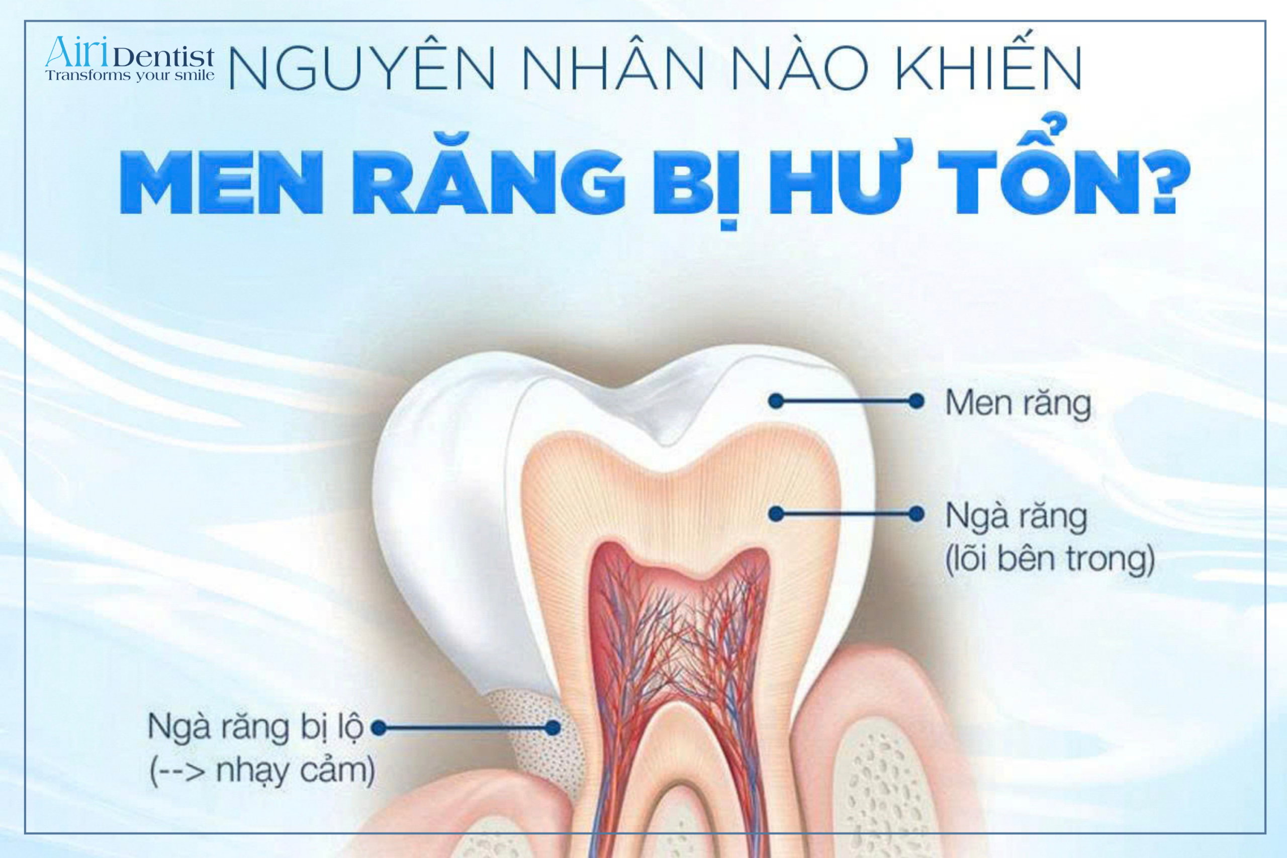 Giải đáp chi tiết các nguyên nhân khiến men răng bị hư từ thói quen sinh hoạt. Hướng dẫn biện pháp nha khoa cụ thể giúp phục hồi và phòng ngừa hiệu quả.